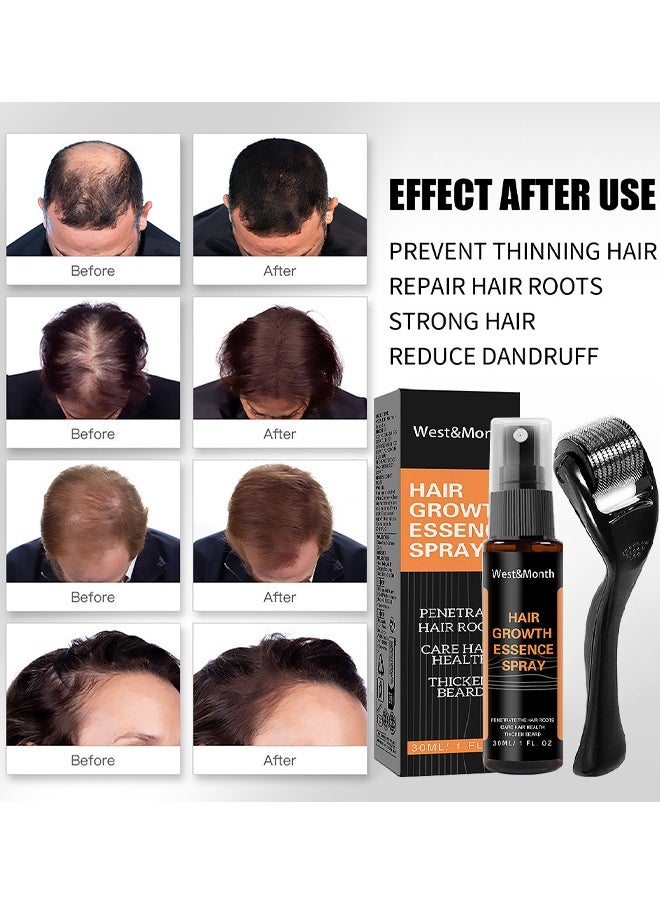 West&Month - 30ML Hair Growth Essence Spray, Anti-Slip Hair Nourishing Growth Liquid Thickening Hairline Essence Spray With Microne Roller, Hair Loss And Thinning Prevention Treatment, Scalp Improver - Image 1