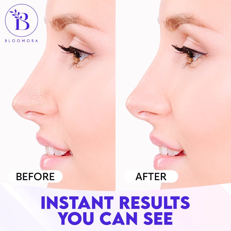 BLOOMORA Nose Pore Strips, Nose Strips Blackhead Remover with Witch Hazel for Deep Cleansing, Pore Cleaner & Whitehead Remover, Skincare For Clearer, Smoother, Radiant Skin (24 pc) - Image 3