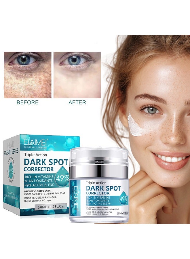 إليمي مصحح البقع الداكنة غني بالفيتامينات ومضادات الأكسدة مزيج نشط 49٪ - كريم مصحح للبقع الداكنة ، علاج الكلف ، علاج فرط التصبغ ، مزيل النمش بحمض الترانيكساميك ، النياسيناميد ، السكوالين وفيتامين E 50 مل - Image 1