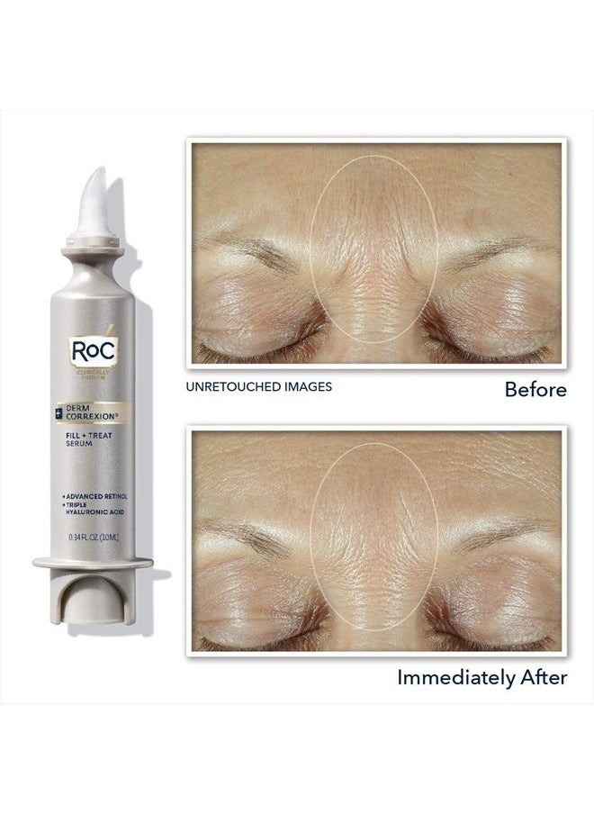 RoC - Derm Correxion Fill + Treat Advanced Retinol Serum, Wrinkle Filler Treatment with Hyaluronic Acid for Forehead Wrinkles, Crow's Feet, Eleven Wrinkles, and Laugh Lines, 15ml - Image 1