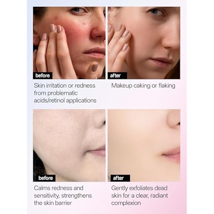 WNP 6D Bionic Collagen Bio‑Gel Mask Overnight Deep Hydration with 5.1% Collagen, Niacinamide, Hyaluronic Acid, Firming, Anti‑Aging, Brightening for Sensitive Skin 28g x 4 - Image 5