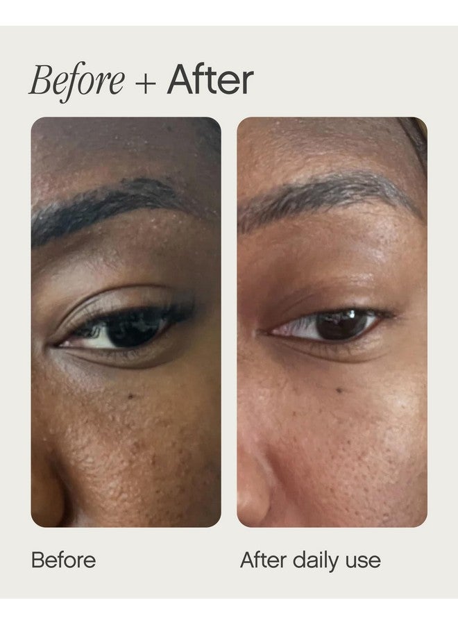 TOPICALS Sealed Active Scar Filling Primer For Acne Prone Skingood For Blemishes Pores Acne & Drynesscontains Retinol And Salicylic Acid1 Oz  - Image 3