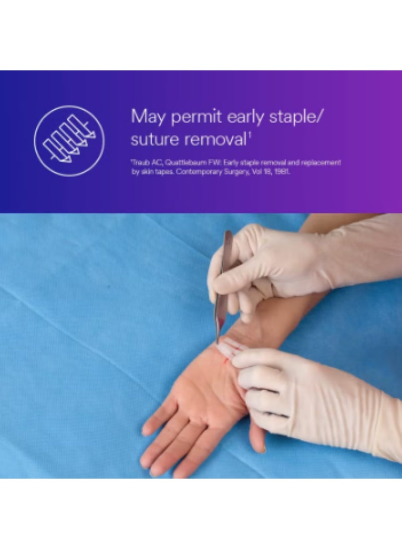 ثري ام شرائط 3M™ ستيري-ستريب™ اللاصقة المعززة لإغلاق الجلد، R1547، 1/2 بوصة × 4 بوصة (12 مم × 100 مم) - Image 4