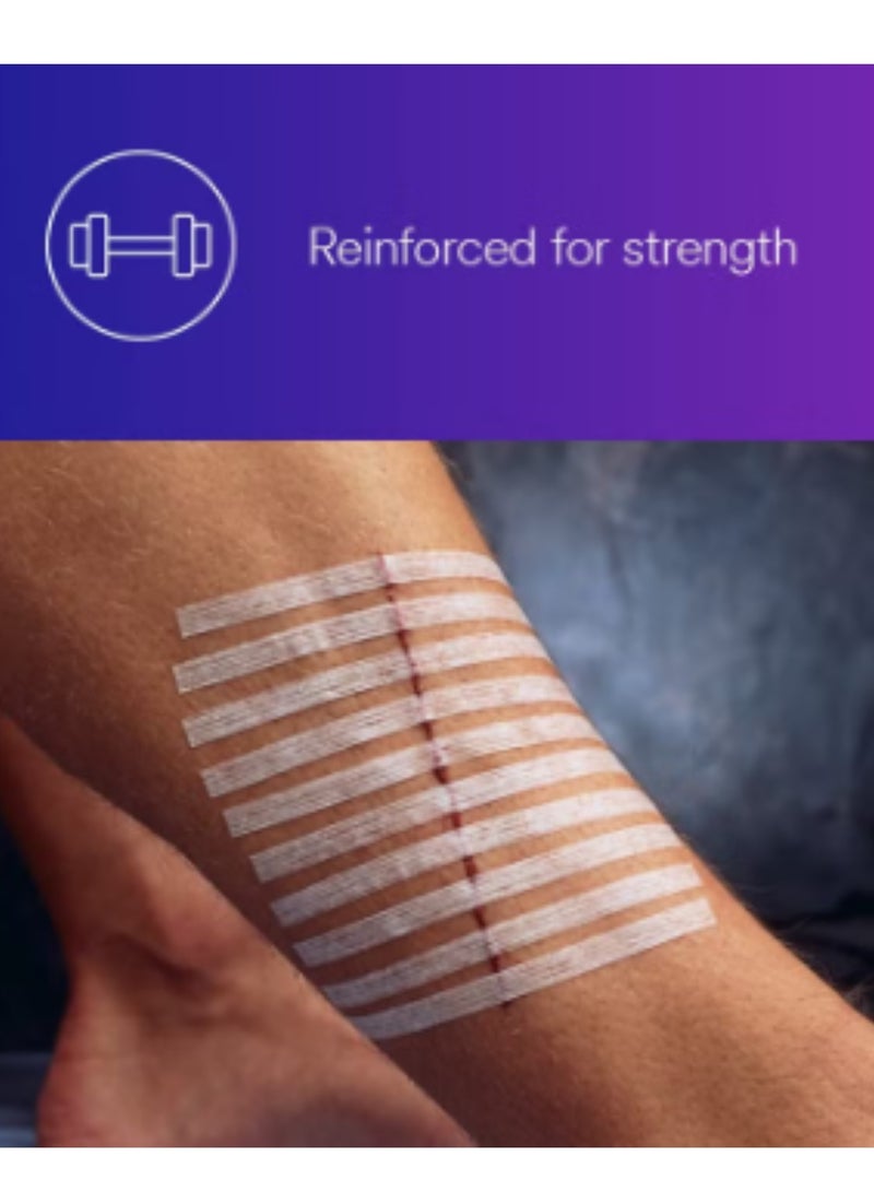 ثري ام شرائط 3M™ ستيري-ستريب™ اللاصقة المعززة لإغلاق الجلد، R1547، 1/2 بوصة × 4 بوصة (12 مم × 100 مم) - Image 5