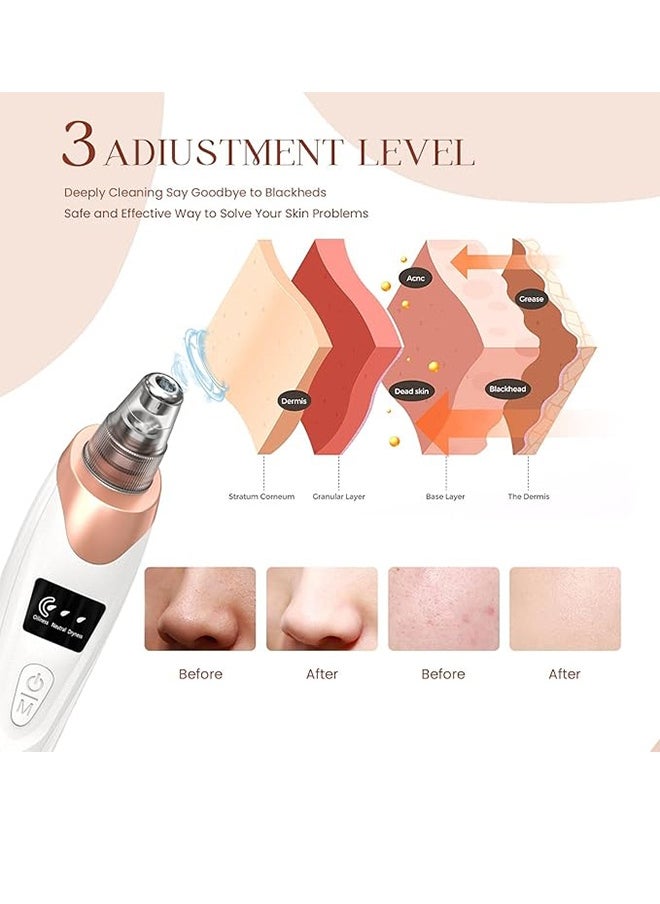 Generic Blackhead Remover Pore Vacuum Cleaner, Facial Pore Cleaner - 5 Suction Powers, 5 Probes, Usb Rechargeable Blackhead Vacuum Kit, Electric Acne Extraction Tool For Adults (White)  - Image 5