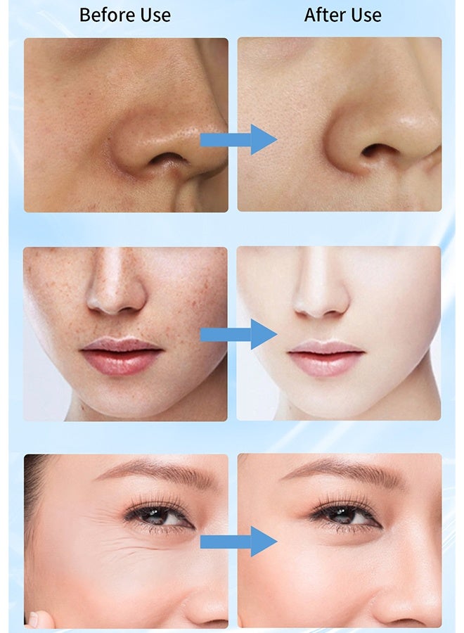 QANZIRE B3 Niacinamide Serum - For Face Removes Blackhead Whitehead Sunspots Dark Circles Improves Elasticity Erase Discoloration For Women 30ml - Image 3