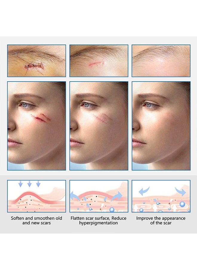 Elaimei - Facial Invisible Scar Roll Sticker,Upgrade Clear Silicone Scar Tape for Scars, Scar Removal Sheets,Scar Strip for Variety of Scars（Transparent） - Image 1