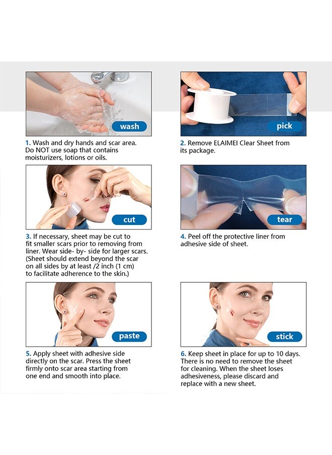 Elaimei - Facial Invisible Scar Roll Sticker,Upgrade Clear Silicone Scar Tape for Scars, Scar Removal Sheets,Scar Strip for Variety of Scars（Transparent） - Image 1
