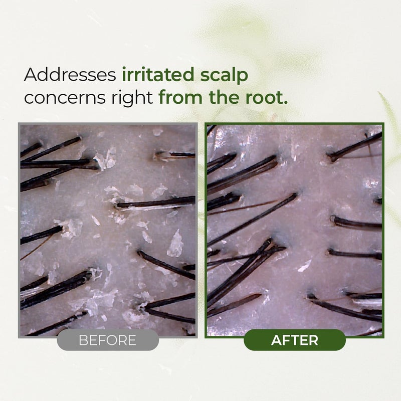 STEAMBASE علاج فروة الرأس من شجرة الشاي من ستيمباس | ينظف ويقشر فروة الرأس الدهنية | BHA طبيعي وشجرة الشاي | يزيل الروائح والتراكمات | مقشر مضاد للحساسية، 8.42 أونصة سائلة - Image 5