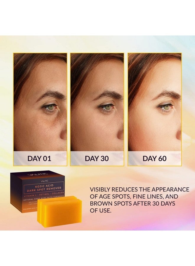 Valitic 2 Pack Kojic Acid Dark Spot Corrector Soap Bars with Vitamin C, Retinol, Collagen, Turmeric - Original Japanese Complex with Hyaluronic Acid & A Pair of Black Exfoliating Gloves for Body Scrub - Image 2