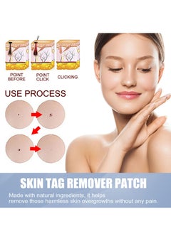 EELHOE Skin Tag Remover Patches Mole Wart Removing Sticker Natural Ingredients 144PCS  - Image 3