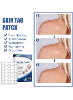 EELHOE Skin Tag Remover Patches Mole Wart Removing Sticker Natural Ingredients 144PCS  - Image 2