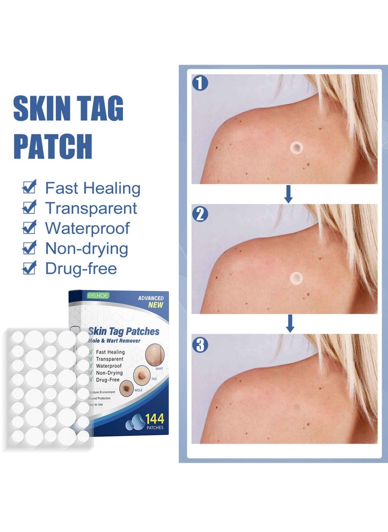 EELHOE Skin Tag Remover Patches Mole Wart Removing Sticker Natural Ingredients 144PCS  - Image 2