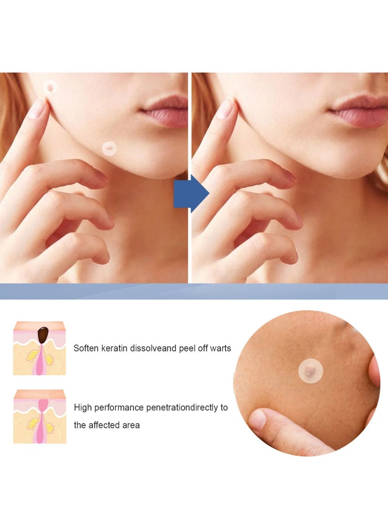 EELHOE Skin Tag Remover Patches Mole Wart Removing Sticker Natural Ingredients 144PCS  - Image 4