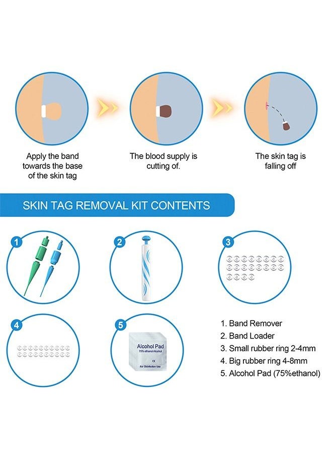 Generic - Chicken Eye Wart Remover Skin Tag Remover,Peel Removing and Redundant Pen Painless Remover Pen,Skin Removal Kit Tools with 40 Micro and Regular Bands Easy Device to Remove (2mm-8mm) - Image 1