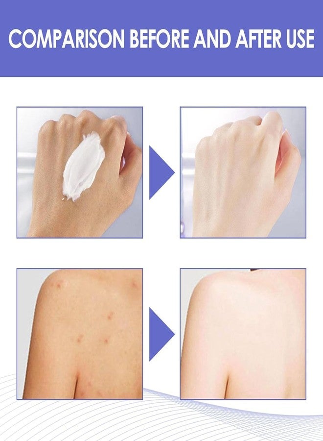 كريم لتفتيح الإبطين والمناطق الحساسة، للبشرة بين الفخذين، بقع الكوعين، مناطق الساقين، الوجه، الإبطين، الركبتين، الرقبة - 50 مل/1.8 أونصة (1 قطعة) - Image 5