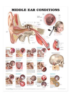 Anatomy Stuff Middle Ear Conditions Anatomical Chart - pzsku/Z151A5E7491D96C00DE63Z/45/_/1737493741/8e7918bb-34b9-4a1e-81ec-a6dbe9eb57f0