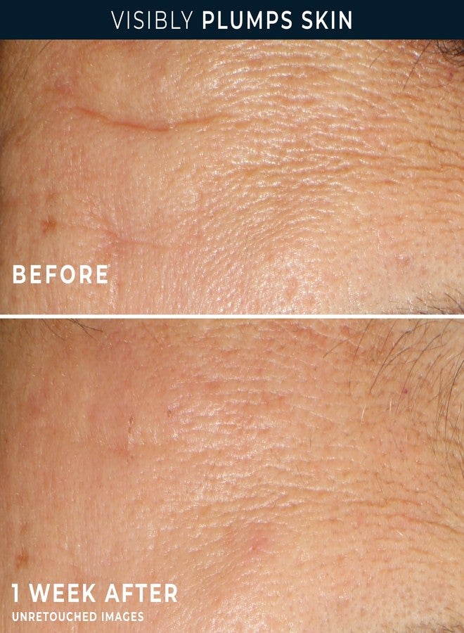 RoC Multi Correxion Hyaluronic Acid Night Serum Capsules (30 CT) for intense hydration + RoC Retinol Capsules (7 CT), Skin Care Routine, Anti-Aging Skin Care Wrinkle Treatment for Women and Men - Image 5