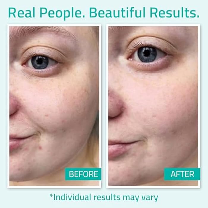 YEOUTH Pure Hyaluronic Acid Serum for Face 99% for Dry & Dull Skin, Hydrating Hyaluronic Acid Face Serum for Women & Men, For All Skin Types 1oz - Image 4