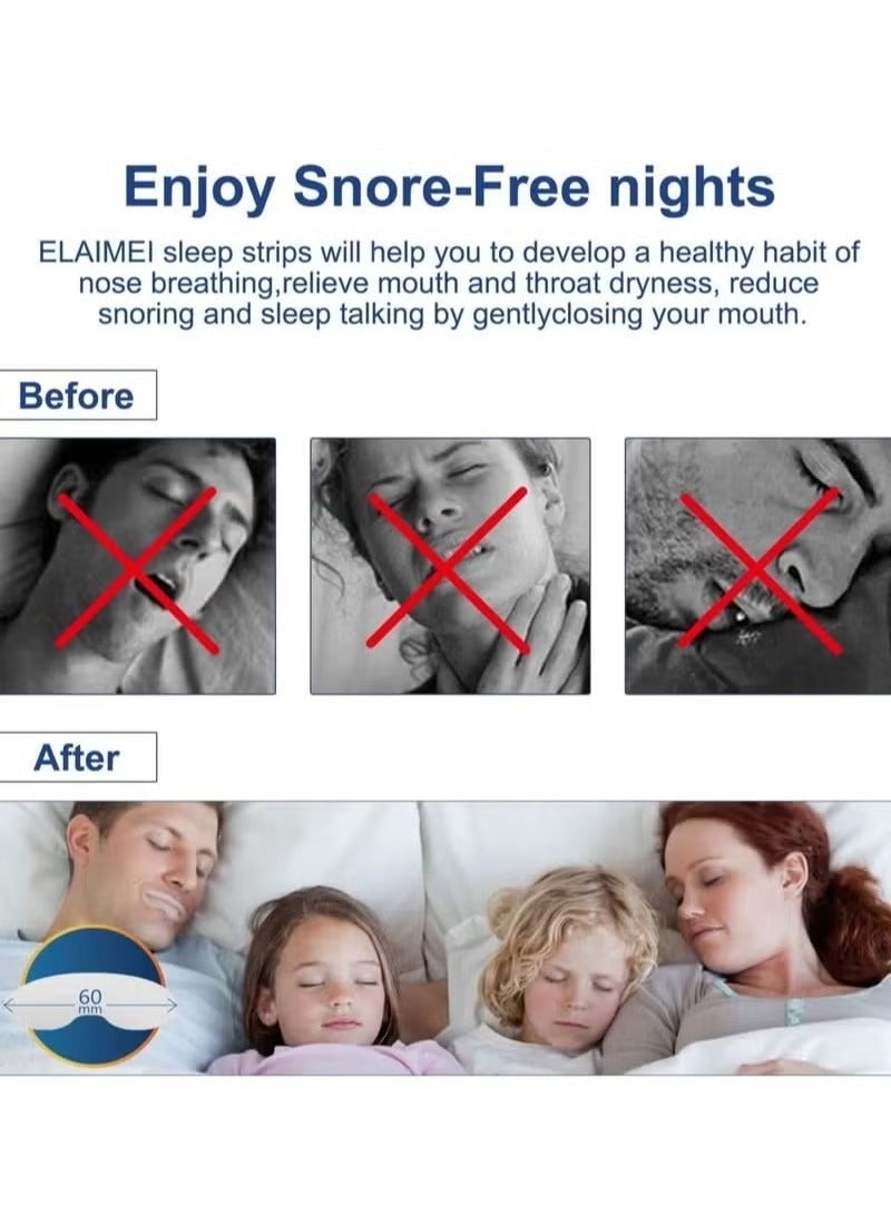 إليمي النوم الفم حزام 90 قطعة من النوم الفم حزام يقلل من درجة عالية من التنفس عن طريق الفم لينة الأنف حزام الفم لتحسين نوعية النوم ووقف الشخير الحل حزام - Image 3
