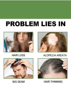 Water Ice Levin Men's Hair Density Serum – Natural Plant-Based Formula to Thicken Hair, Reduce Thinning & Revitalize Follicles for Fuller, Healthier Hair  - Image 3