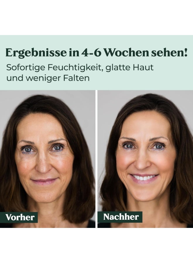 كوسفيرا كريم هيالورون بيرفورمانس بحجم 50 مل – كريم نباتي (فيغان) للنهار والليل بتركيز عالٍ، مخصص للوجه والرقبة ومنطقة الصدر وتحت العين. يوفر ترطيباً عميقاً، ينعّم الخطوط الدقيقة، ويساعد على تقليل التجاعيد. مناسب للرجال والنساء. مصنوع في ألمانيا. - Image 5