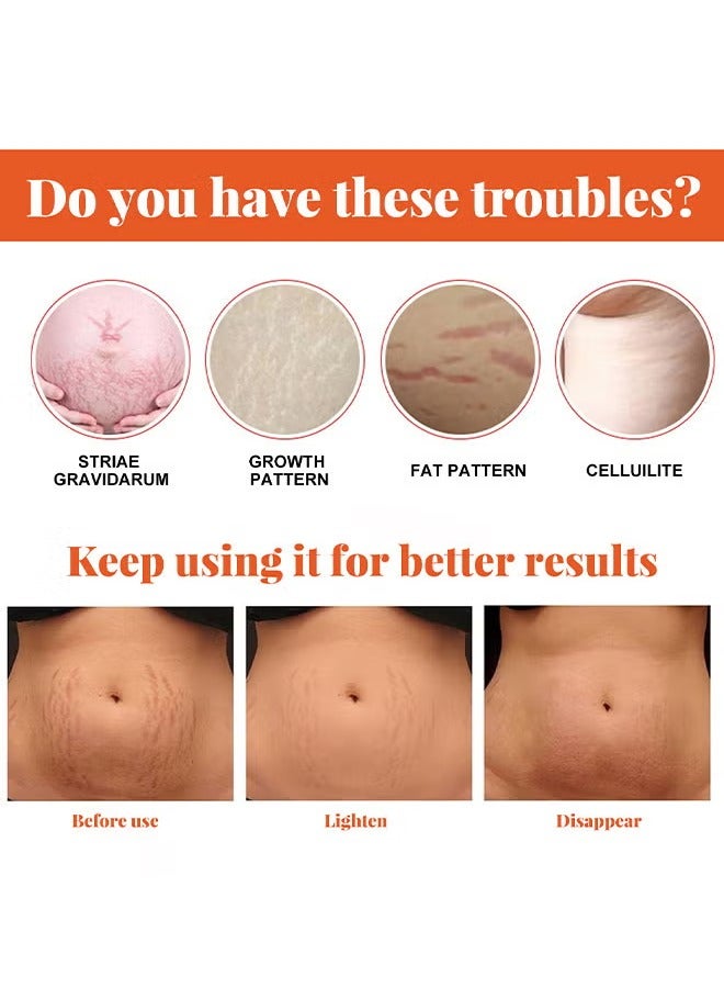إيلهو علامات التمدد إصلاح الزيت الأساسي، علامات التمدد وإزالة الندوب زيت للحمل علامات التمدد الندوب زيت البطن، للتجاعيد السمنة علامة التمدد ترطيب إزالة علامات 20ML - Image 5