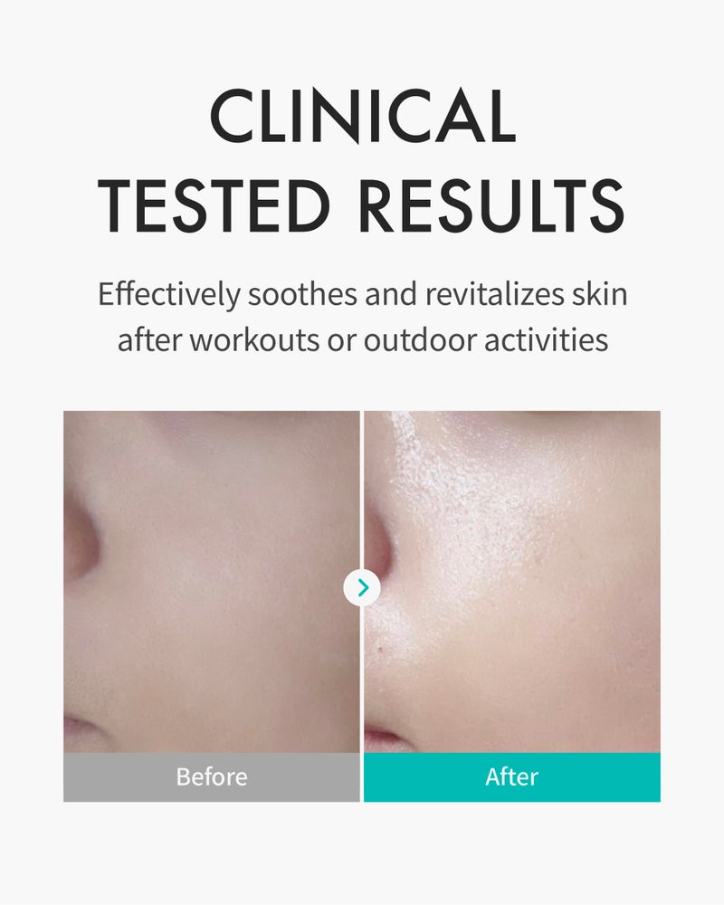 REJURAN قناع حماية البشرة REJURANÂ®، c-PDRNÂ® - قناع وجه مرطب ومهدئ للبشرة المتهيجة والمجهدة، يصلح ويعيد بناء حاجز البشرة مع بانثينول وألانطوين، العناية بالبشرة الكورية. 5 عبوات - Image 3
