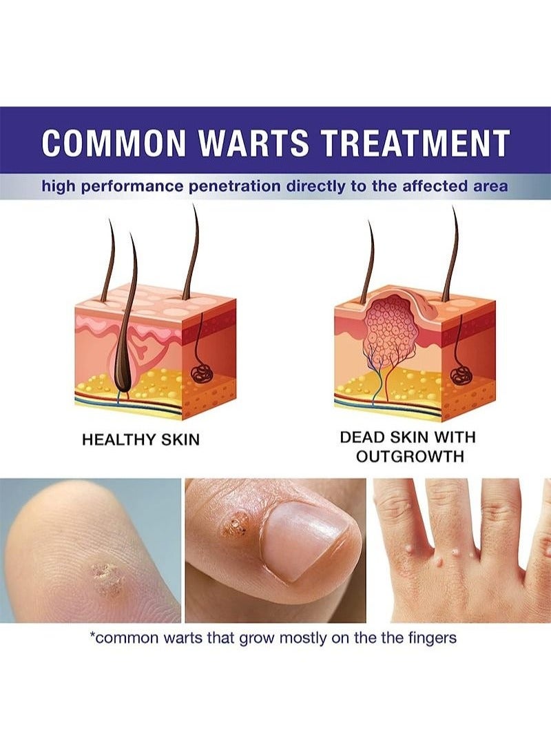 HEALMUSZ حل إزالة الثآليل والذرة بتركيبة حصرية، حل سائل لإزالة الثآليل، حل سريع المفعول لإزالة الذرة للثآليل الأخمصية، الذرة، الثآليل الشائعة والثآليل المسطحة - Image 2