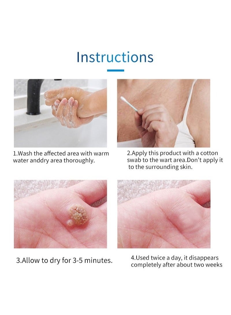 HEALMUSZ حل إزالة الثآليل والذرة بتركيبة حصرية، حل سائل لإزالة الثآليل، حل سريع المفعول لإزالة الذرة للثآليل الأخمصية، الذرة، الثآليل الشائعة والثآليل المسطحة - Image 5