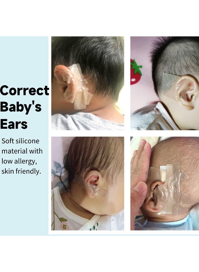 Crumye Baby Ear Corrector, Infant Ear Tape for Babies, Baby Silicone Gel Ear Tape 4cmx50cm Perfect Tape for Correcting Newbornâ€™s Ear - Image 5