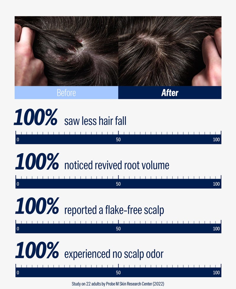 DASHU Revitalizing Protein Shampoo for Dry, Itchy Scalp, Thinning Hair, and Men - 16.9 fl oz - Image 2