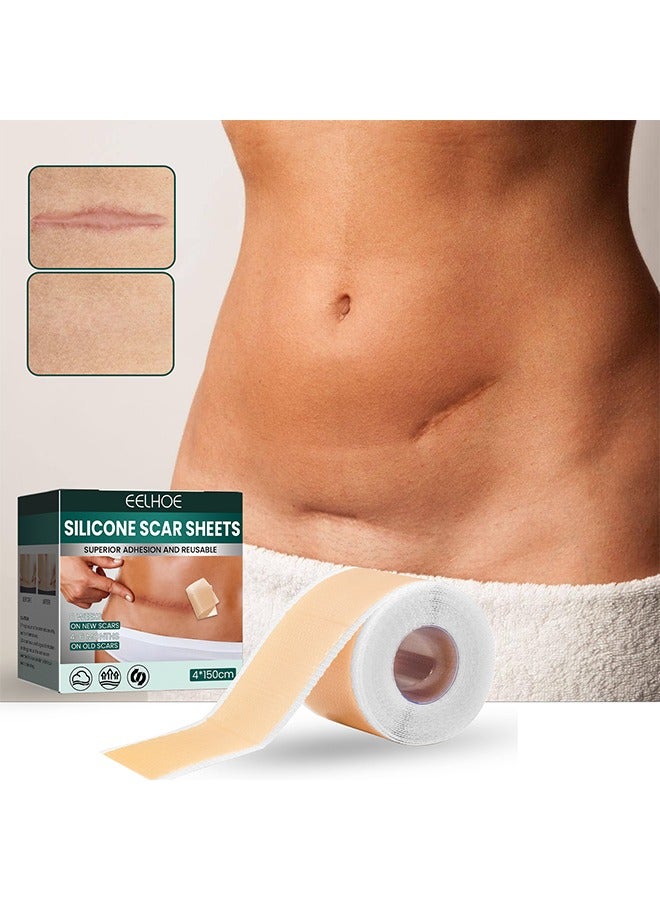 EELHOE Silicone Scar Tape for Surgical Scars - 4*150cm/Roll - Long Scar Repair Patch Sheets for C-Section, Tummy Tuck, Keloid, and Surgical Scars - Image 1