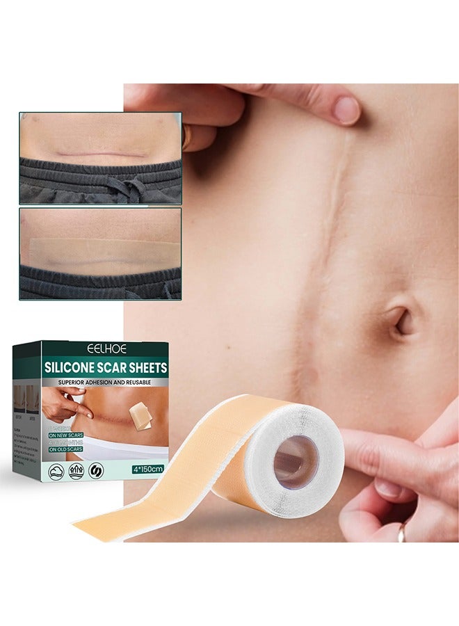 EELHOE Silicone Scar Tape for Surgical Scars - 4*150cm/Roll - Long Scar Repair Patch Sheets for C-Section, Tummy Tuck, Keloid, and Surgical Scars - Image 2