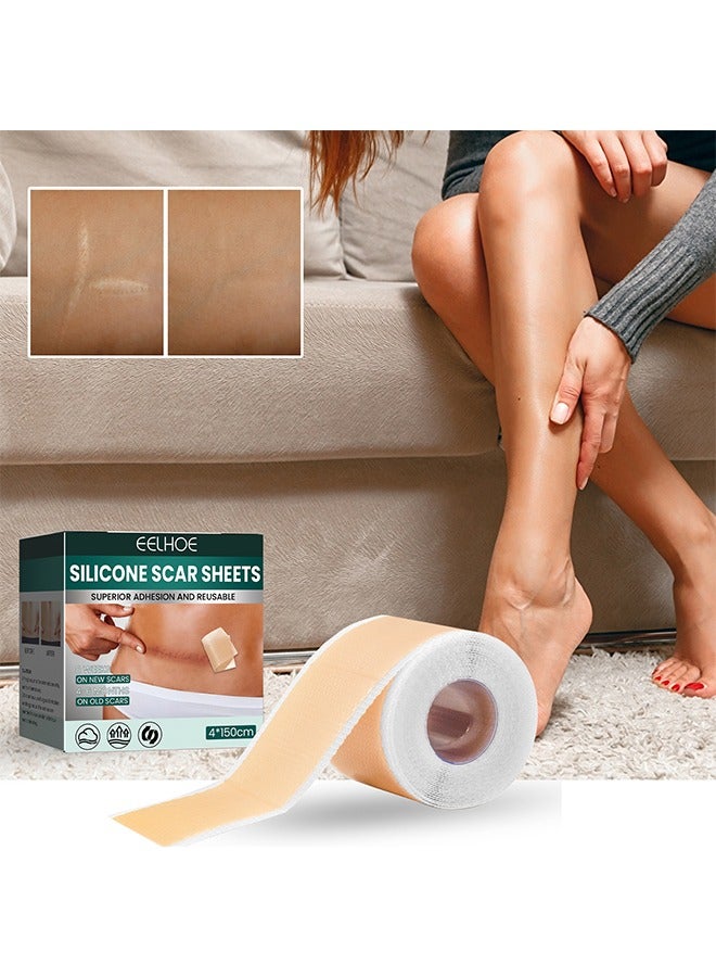 EELHOE Silicone Scar Tape for Surgical Scars - 4*150cm/Roll - Long Scar Repair Patch Sheets for C-Section, Tummy Tuck, Keloid, and Surgical Scars - Image 5