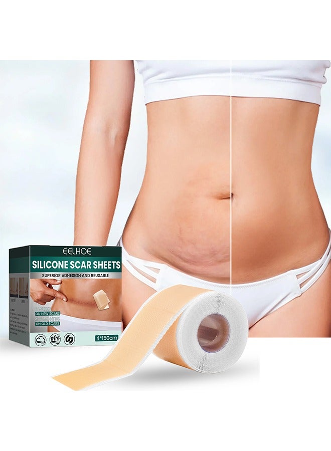 EELHOE Silicone Scar Tape for Surgical Scars - 4*150cm/Roll - Long Scar Repair Patch Sheets for C-Section, Tummy Tuck, Keloid, and Surgical Scars - Image 4