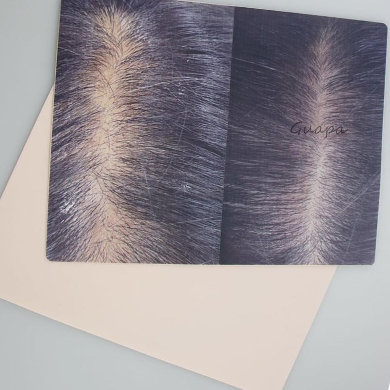 Guapa 2pcs Male and Female Scalp Micropigmentation Practice Skin for Thinning Hair Tattoo and Hair Density Practice Pad (Mix) - Image 2