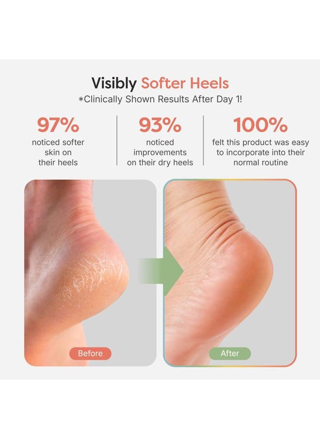 Zentoes - Moisturizing Socks for Cracked Heel Treatment - Vitamin E, Olive Oil and Jojoba Oil Infused to Soften and Hydrate - Heel Socks for Dry Cracked Feet Women (Fuzzy Black, Regular) - Image 1