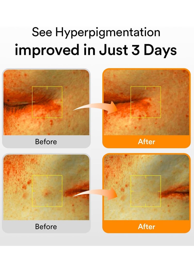 abib سيروم فيتا دروب لعلامات الداكنة - جلوتاثيون، نياسيناميد، حمض الأسكوربيك (50 مل) - Image 3