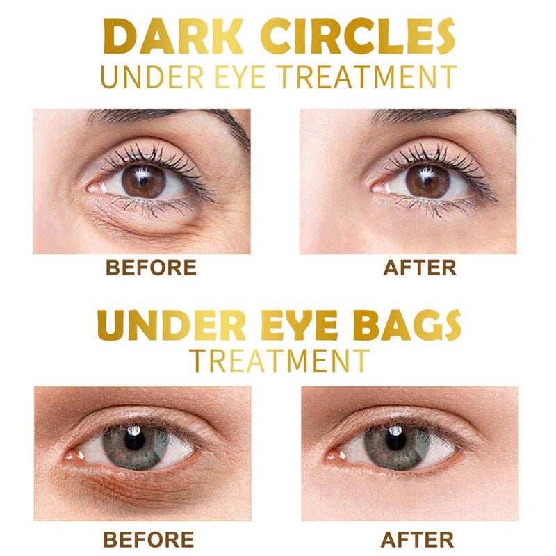 Felico Under Eye Patches, 30 Pairs Gold Eye Mask, Eye Gel Pads With Collagen Treatment for Reducing Dark Circles, Lighten Wrinkles Anti-Aging Moisturizing, Fine Lines Eye Bags Puffiness for Women Men - Image 4