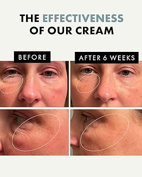 Eclat Skincare Under Eye Cream for Dark Circles Puffiness Anti Aging Formula for Wrinkles Moisturizer for Fine Lines Crows Feet Eye Bags Hydrating Treatment for Firming Smoothing 30ml - Image 2