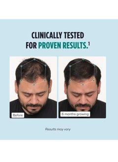 NUTRAFOL Nutrafol Men's Hair Growth Supplements, Clinically Tested for Visibly Thicker Hair and Scalp Coverage, Dermatologist Recommended - 1 Month Supply  - Image 3