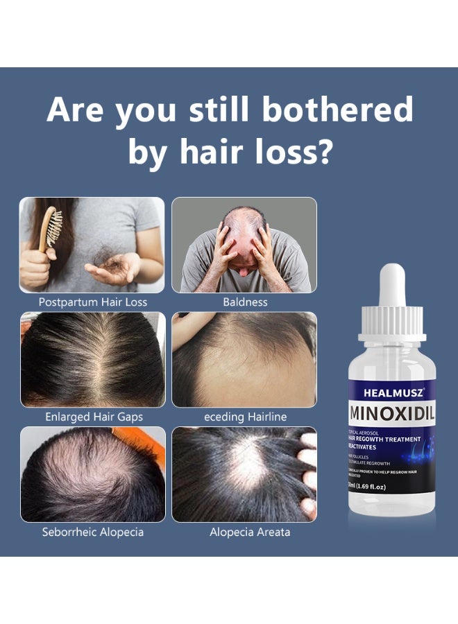 HEALMUSZ HEALMUSZ Minoxidil Hair Growth Spray – Stimulates hair follicles, volumizes and strengthens hair, nourishes hair roots, prevents hair loss, fragrance-free 50ml*2 - Image 5