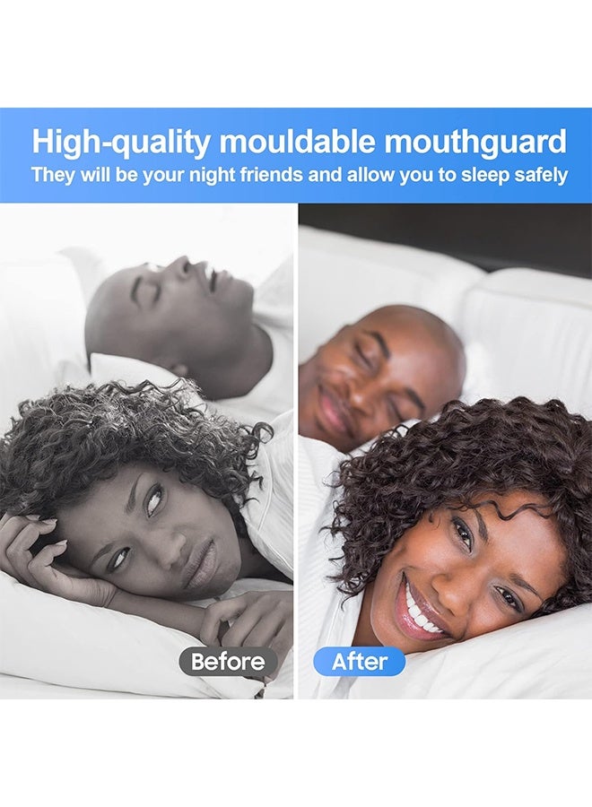 JS 4 Pack Moldable Mouth Guards for Teeth Grinding – Night Guard for Clenching with Hygiene Case, Includes 2 Regular & 2 Heavy Duty Guards - Image 3
