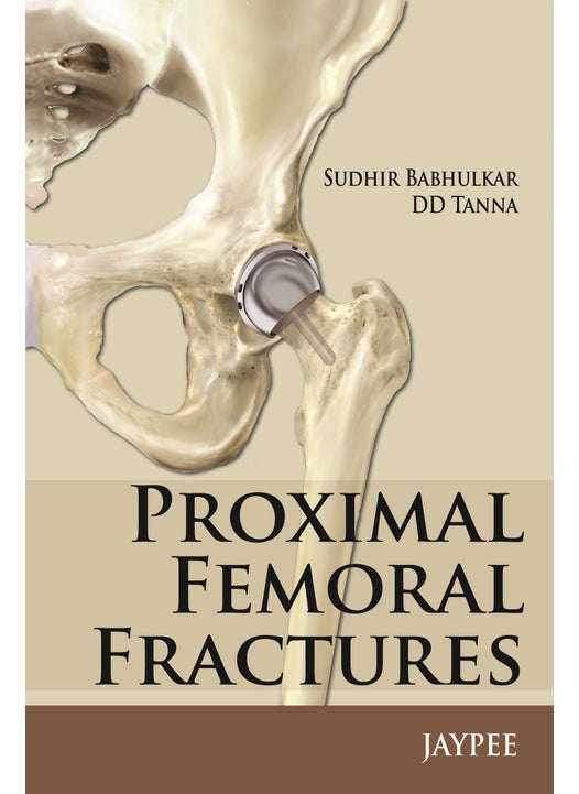 Proximal Femoral Fractures