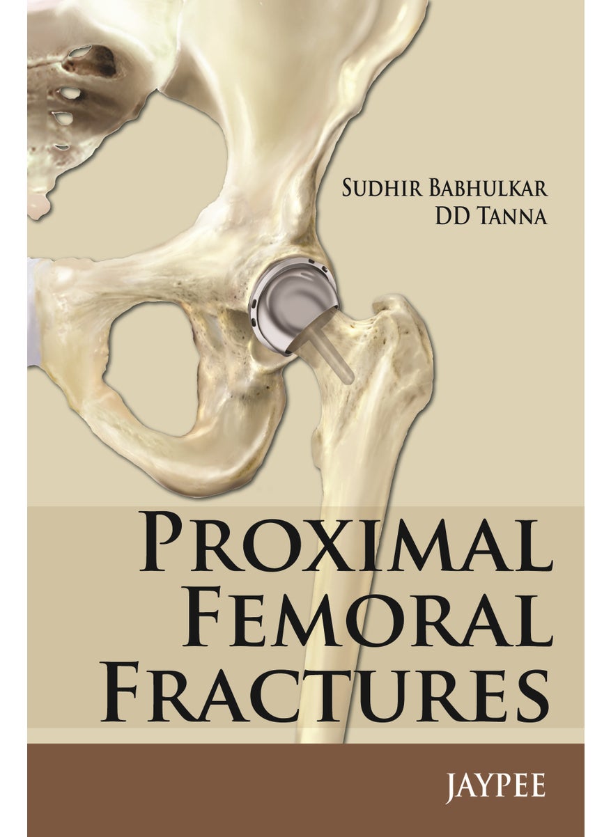 Proximal Femoral Fractures 