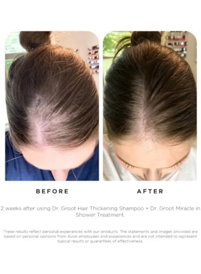 Dr.Groot Hair Thickening Shampoo for Loss, Korean Care With Biotin, Rosemary Oil to Help Volumize Thinning, Damaged Hair, Hydrate Scalp, Revitalizing Solution - Image 5