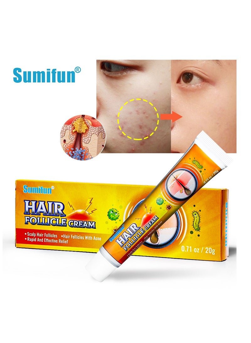 Sumifun Hair Follicle cream Skin Care for Inflamed Follicles & Pore Repair - Deep Penetration, Inhibits Bacterial Growth - Image 1