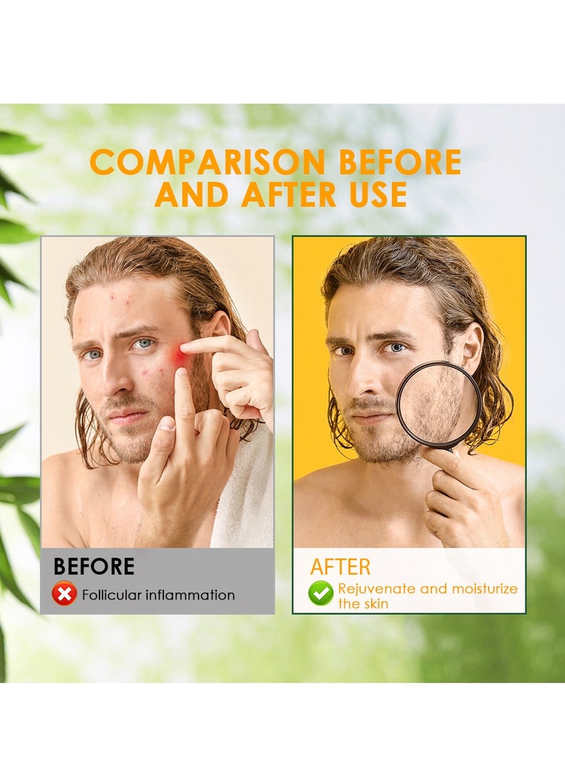 Sumifun Hair Follicle cream Skin Care for Inflamed Follicles & Pore Repair - Deep Penetration, Inhibits Bacterial Growth - Image 3