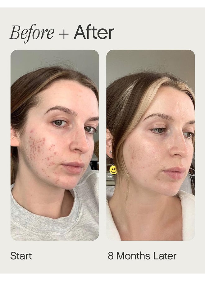TOPICALS Brightening And Clearing Serum, Reduces Discoloration, Post-Blemish Marks, Scars And Spots, For Uneven Skin Tone, 15ML  - Image 5